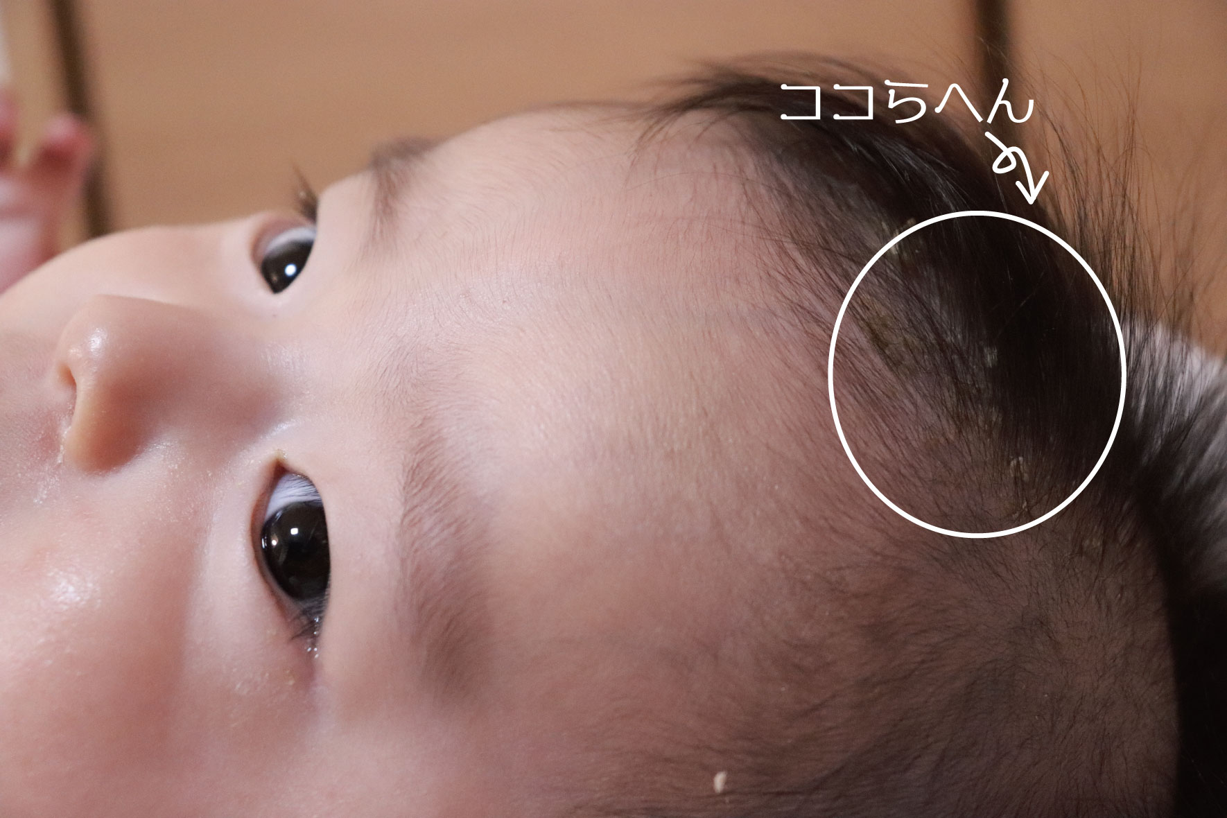 愛しの頭皮マーメイド再び パパライフブログ